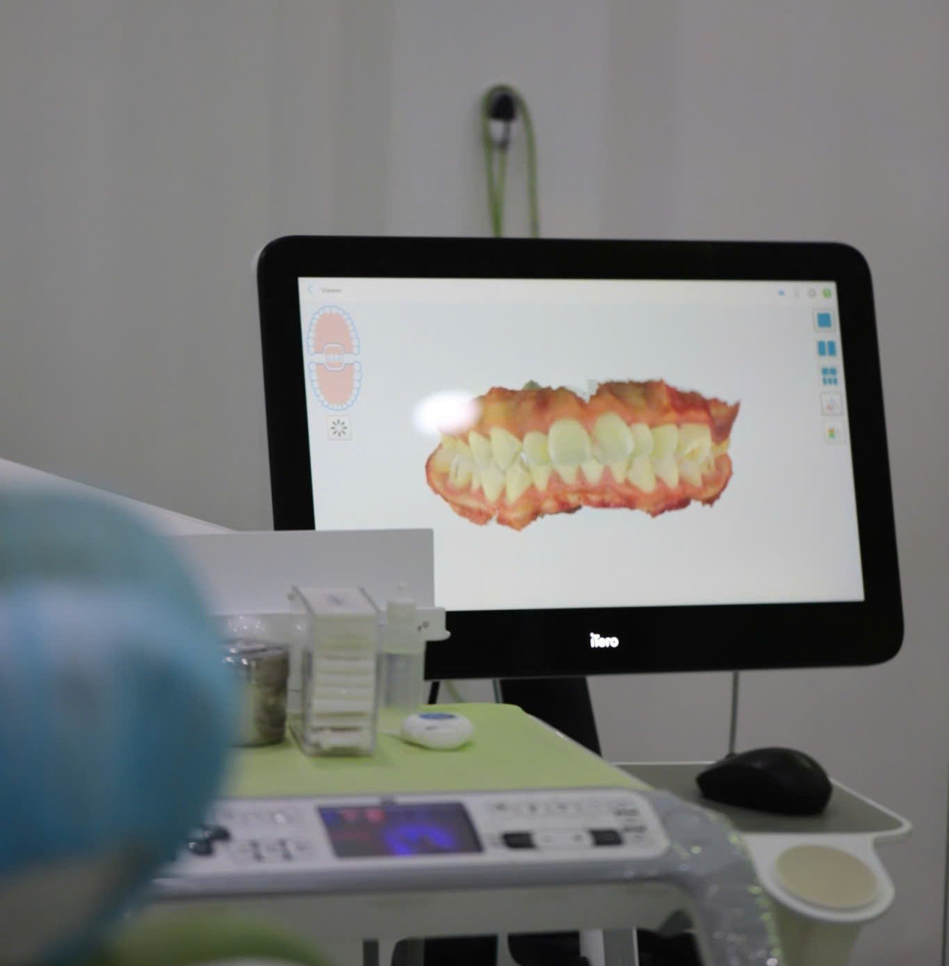 Máy Scan iTero Element 5D Plus